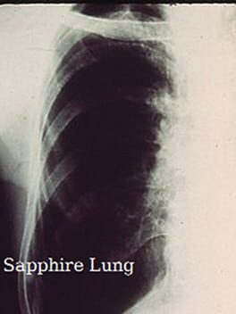 Cover Sapphire Lung
