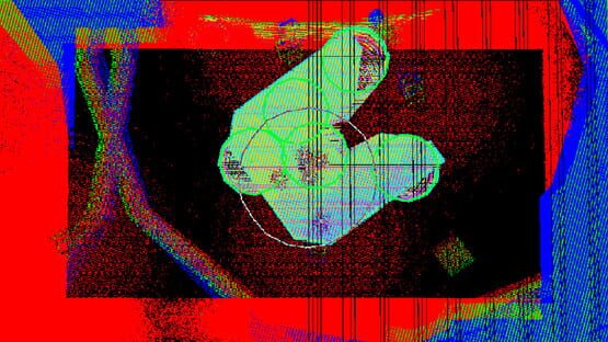 Screenshot Nerve Damage